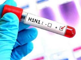 4º caso de H1N1 é confirmado em Não-Me-Toque